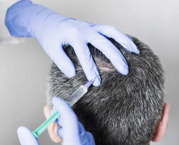 hair-filler-1